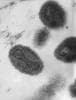 Image for White House halts research into &#8216;super strains&#8217;