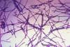 Featured image for CDC Employees Exposed To Anthrax